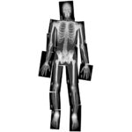 Image Radio du corps humain - Pochette de 18